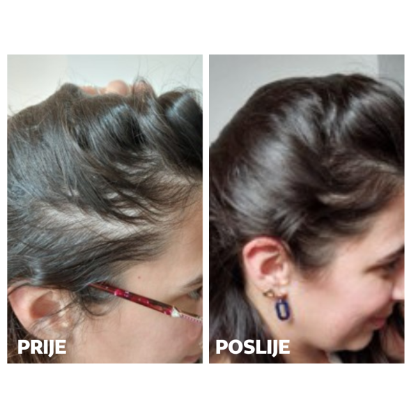 HAIR PROMO PACK ZA NJU - Slika 6