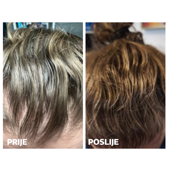 HAIR PROMO PACK ZA NJEGA - Slika 5