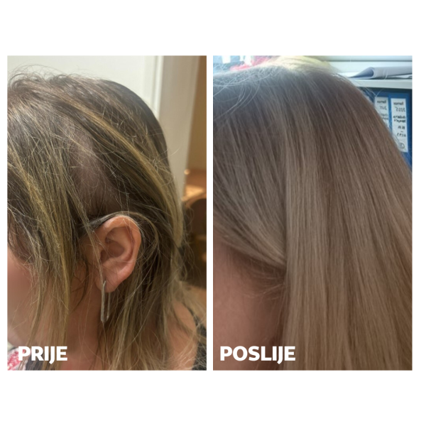 HAIR PROMO PACK ZA NJU - Slika 5