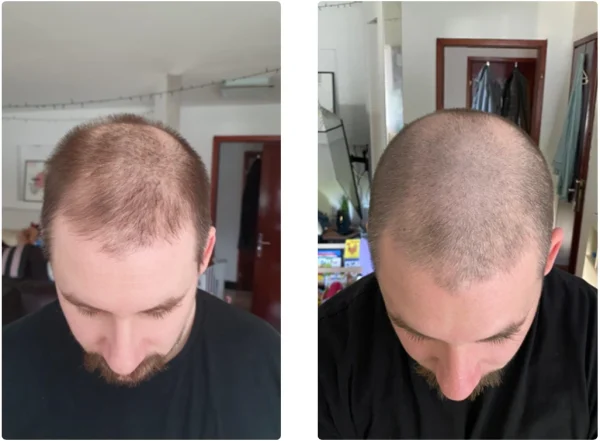 HAIR PROMO PACK ZA NJEGA - Slika 6